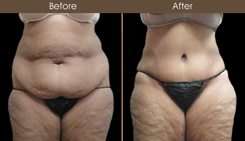 20202608154513_B186-Front-Template